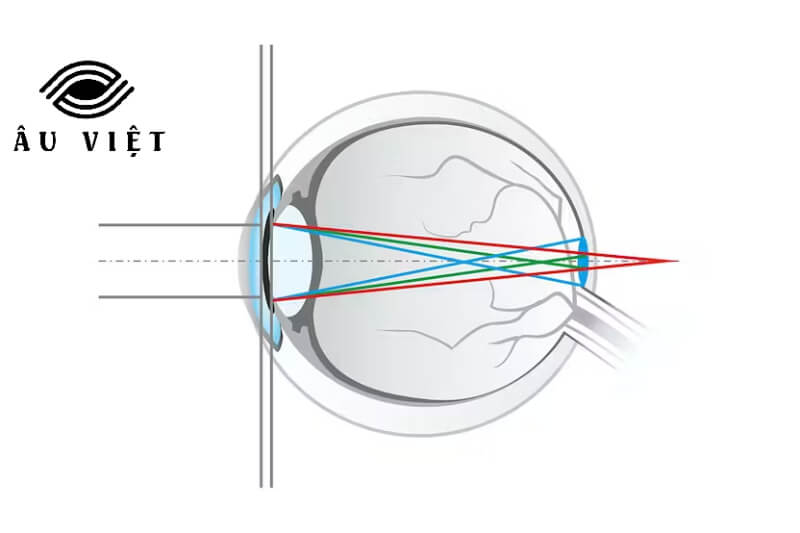 Tròng Kính Đổi Màu Ánh Sáng Xanh Zeiss 